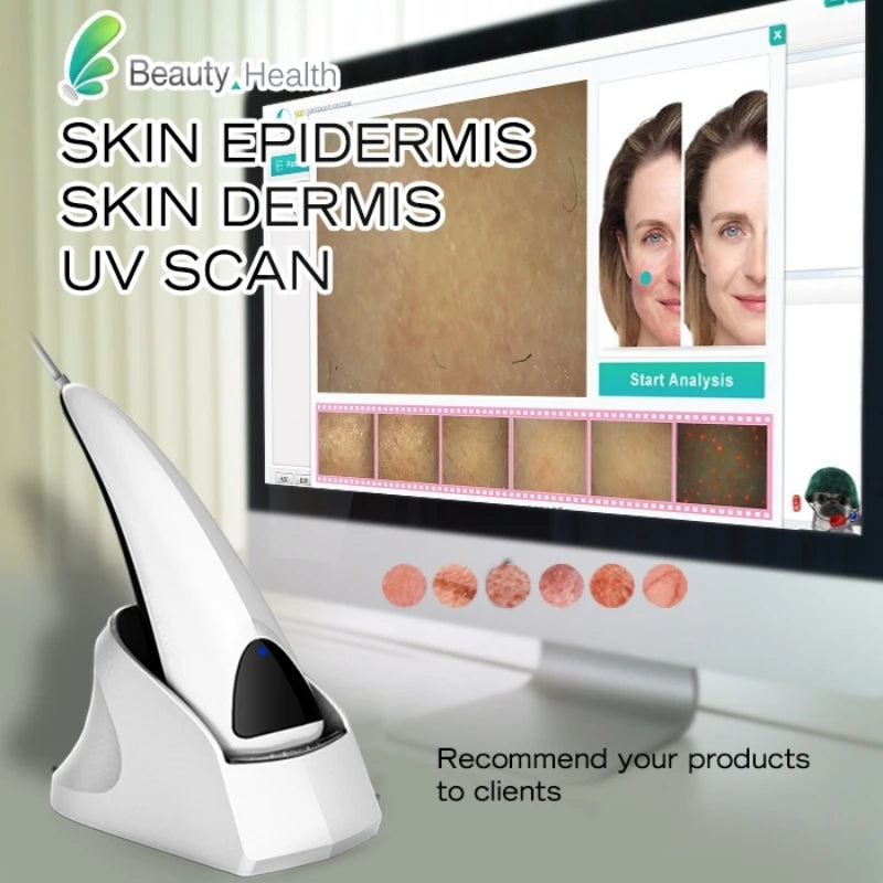 Skin analysis device with computer screen displaying skin examination software.
