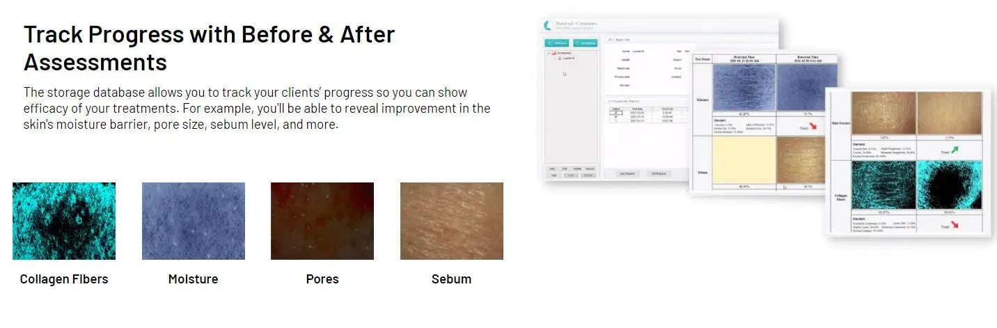 Before and after assessments for skin analysis with color swatches and software interface.
