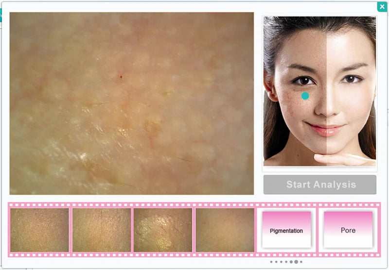 Skin analysis software interface with a split-screen showing skin texture and a face, with options for 'Pigmentation' and 'Pore' analysis.