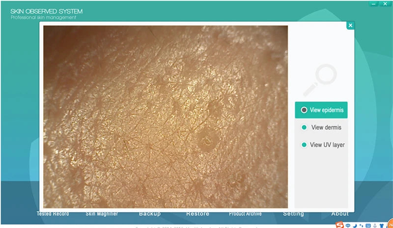 Skin observed system software interface displaying skin texture analysis.