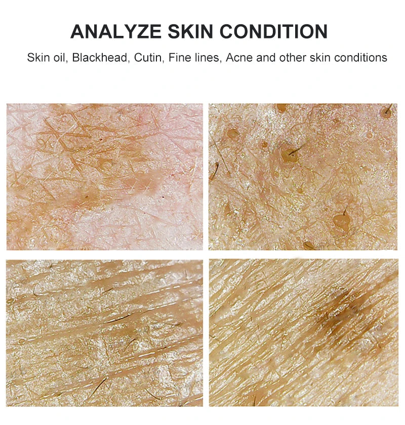 Four images of skin conditions with text above them.